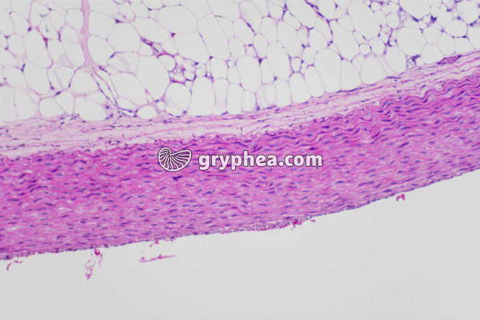 Paroi artérielle x25 - gryphea.com